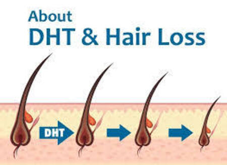 DHT Blockers for Hair Loss Benefits Options